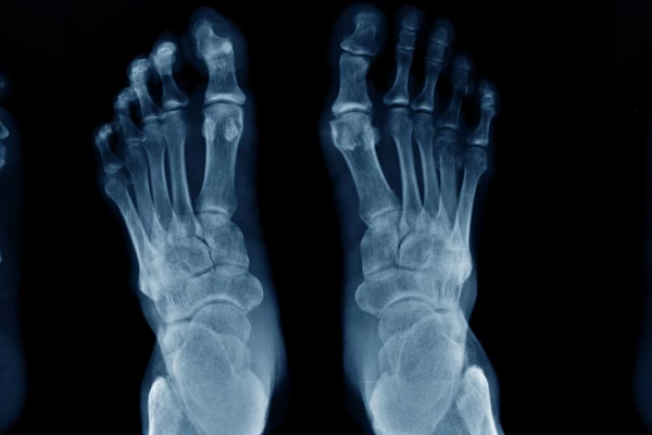 Cirugía de pie y tobillo