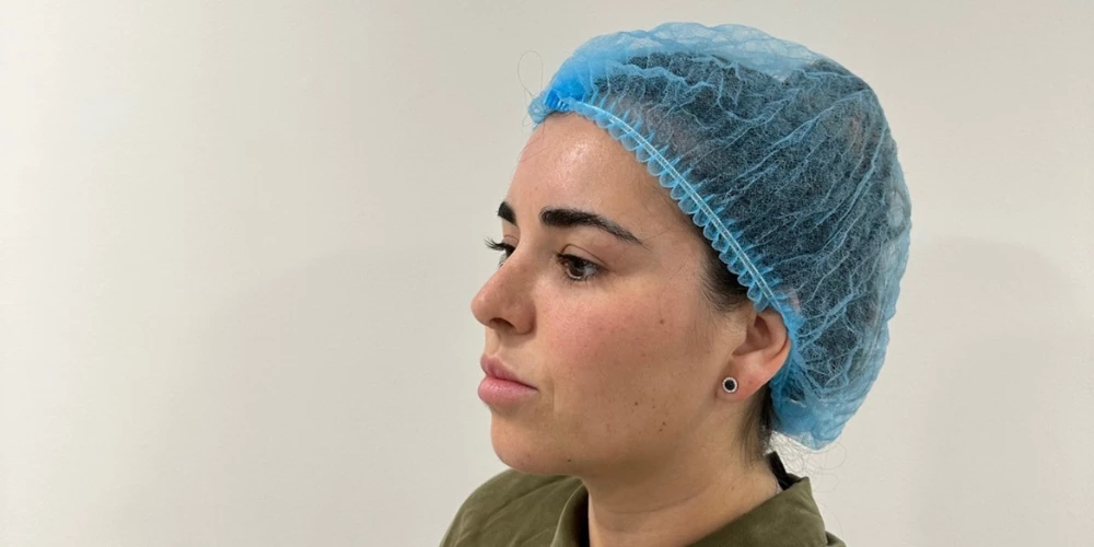 Marcación mandibular (2)