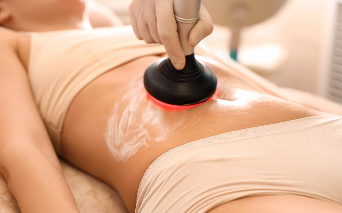 Tratamiento con radiofrecuencia 