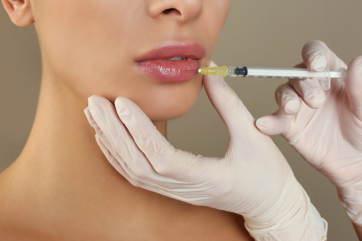 aumento de labios sabadell - 2