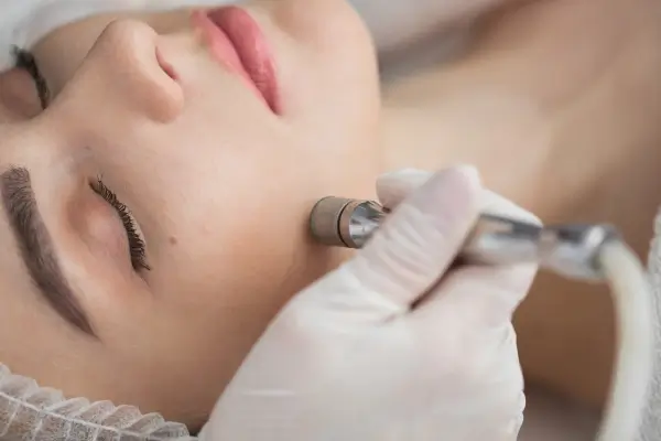 Fotorejuvenecimiento