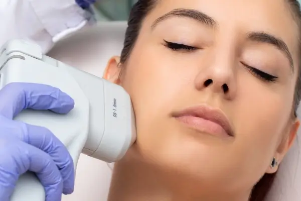 Dermapen facial