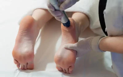 Ondas de choque en podología: cómo funciona este tratamiento y para qué patologías está indicado