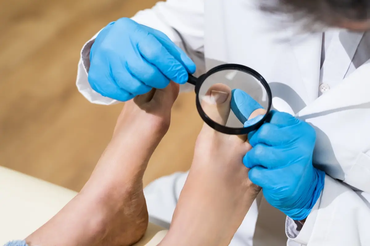 Uñas encarnadas de los pies