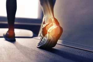 Podología deportiva cómo prevenir lesiones y mejorar el rendimiento físico (1)