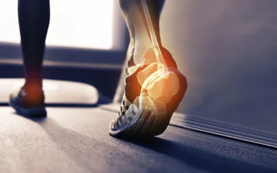 Podología deportiva: cómo prevenir lesiones y mejorar el rendimiento físico