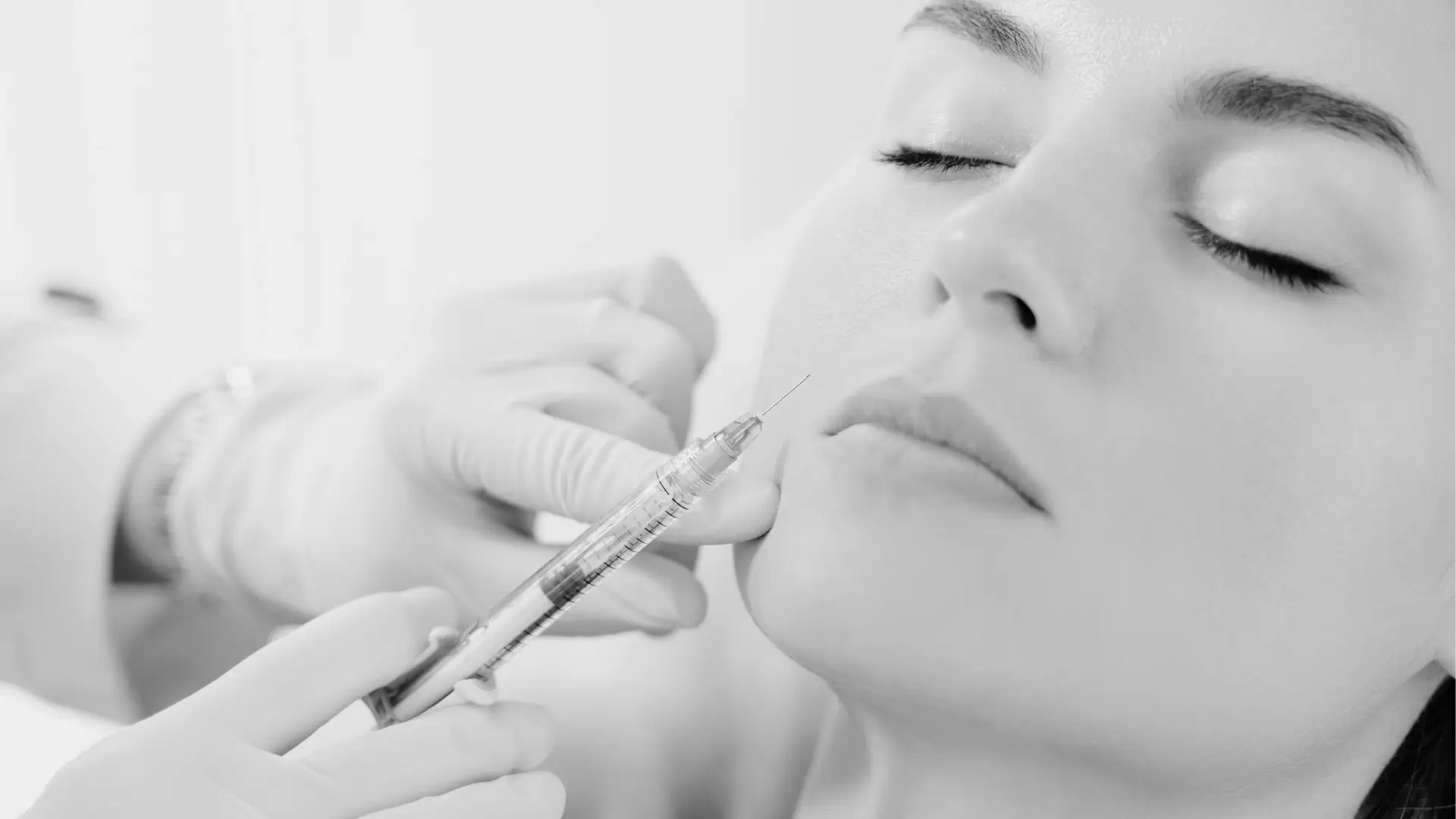 Bioestimulación facial