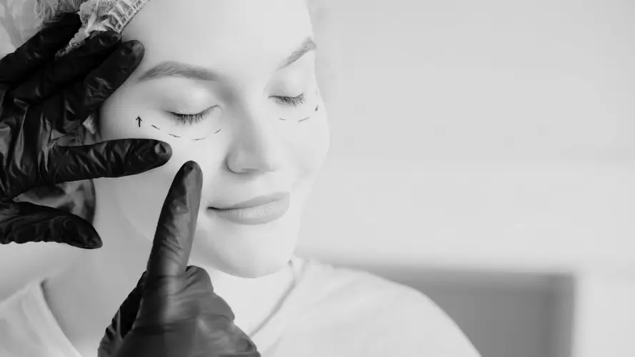 Bleferoplastia inferior