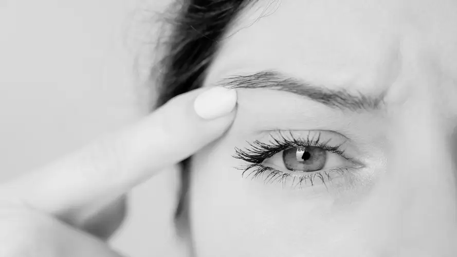 Bleferoplastia superior