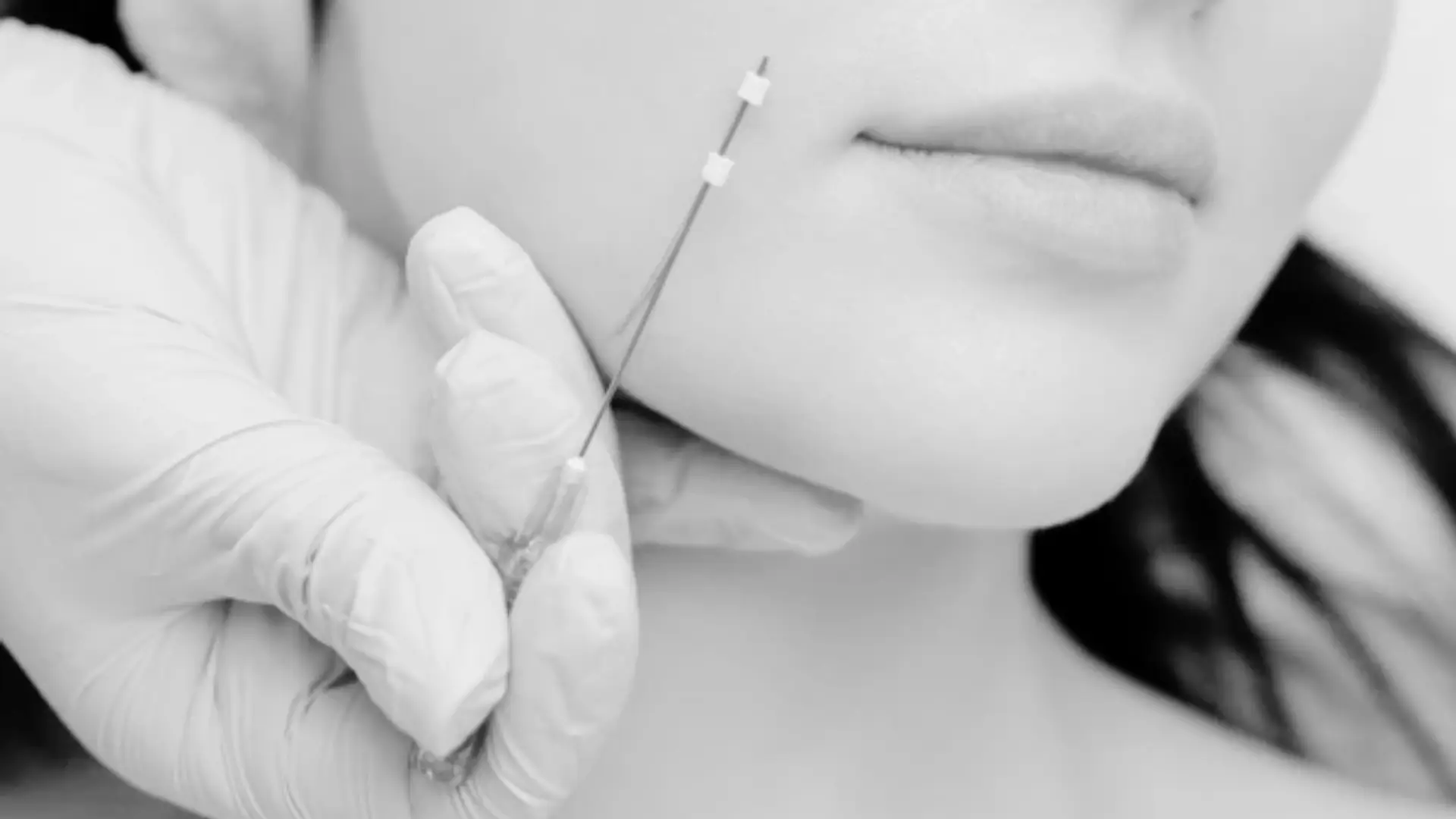 Lifting con Hilos Tensores Lifting con Hilos Tensores