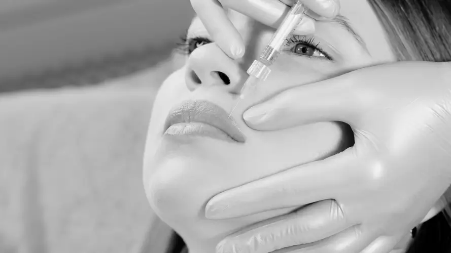 Relleno del surco nasogeniano