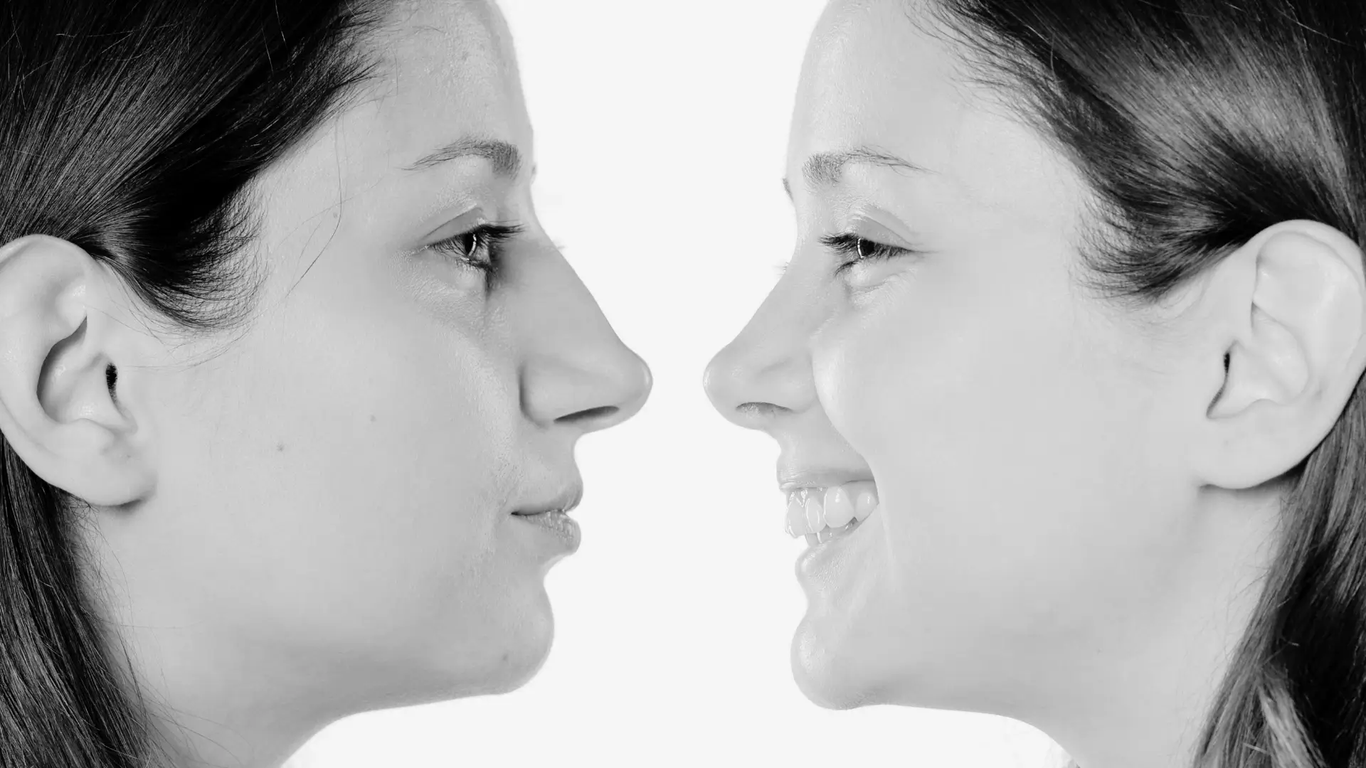 Rinoplastia Ultrasónica Rinoplastia Ultrasónica