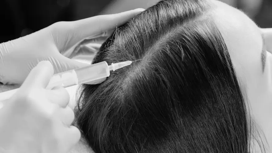 Terapia capilar integral